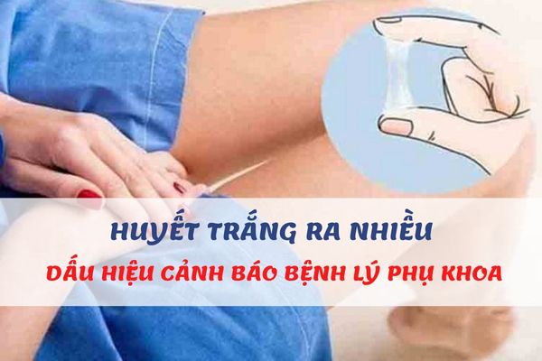 Huyết trắng ra nhiều ở vùng kín – Dấu hiệu cảnh báo bệnh lý phụ khoa nguy hiểm