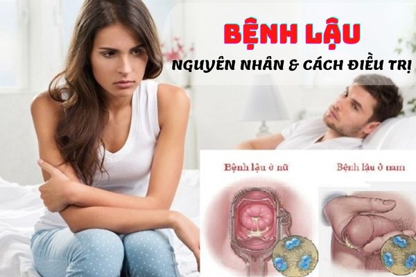 Bệnh lậu là gì? Nguyên nhân và cách điều trị hiệu quả nhất