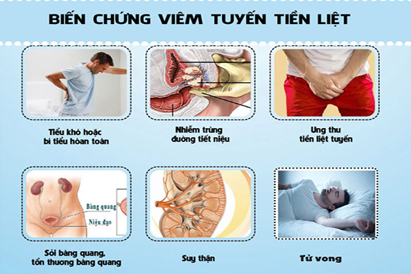 Bien-chung-viem-tuyen-tien-liet