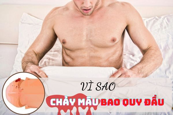 Chay-mau-bao-quy-dau