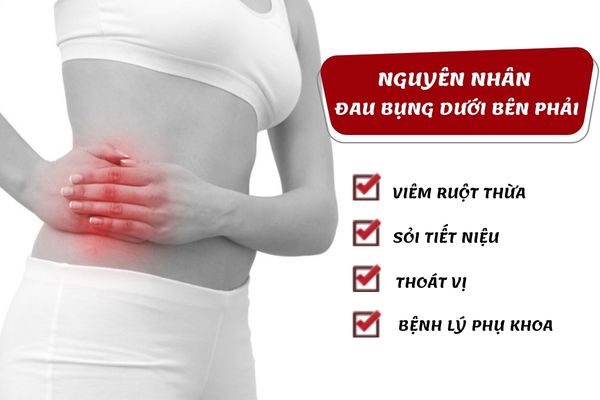 Đau bụng dưới bên phải là cảnh báo của nhiều bệnh lý khác nhau