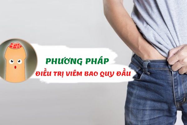 Phương pháp điều trị viêm bao quy đầu – Địa chỉ chữa bệnh uy tín