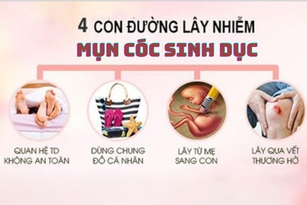 Mụn cóc sinh dục lây nhiễm qua nhiều con đường khác nhau