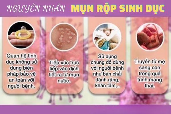 Nguyên nhân gây bệnh mụn rộp sinh dục