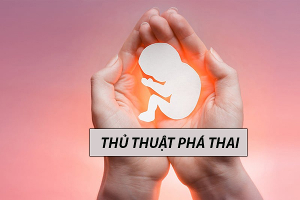 Một số thủ thuật phá thai an toàn được áp dụng phổ biến