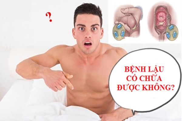 Bệnh lậu có chữa được không? Cách điều trị như thế nào?