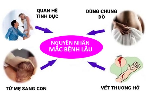 Benh-lau-lay-qua-duong-nao