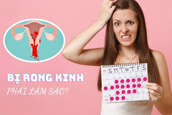 Giải đáp thắc mắc] Bị rong kinh phải làm sao?