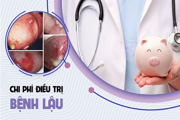 Chi phí điều trị bệnh lậu có đắt không?