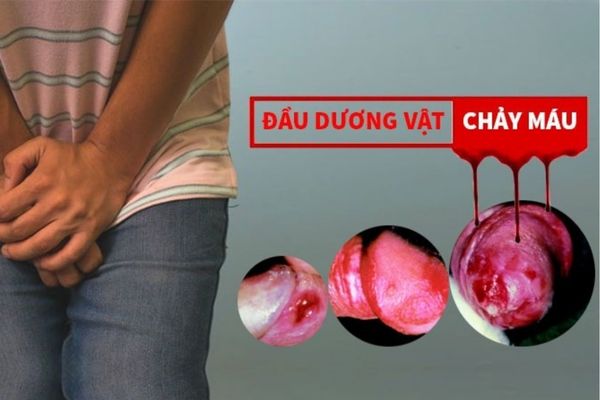 Duong-vat-chay-mau