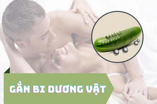 Gắn bi dương vật là gì? Lợi ích mà thủ thuật mang lại