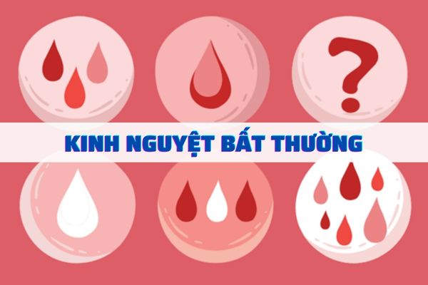 Tổng hợp các dấu hiệu kinh nguyệt bất thường mà chị em cần nắm