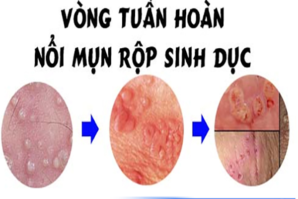 Mun-rop-sinh-duc-giai-doan-phat-trien