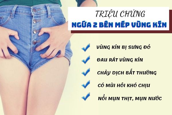 Các triệu chứng ngứa 2 bên mép vùng kín phổ biến nhất