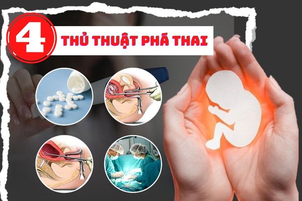 Sùi mào gà ở dương vật – Dấu hiệu nhận biết và cách điều trị