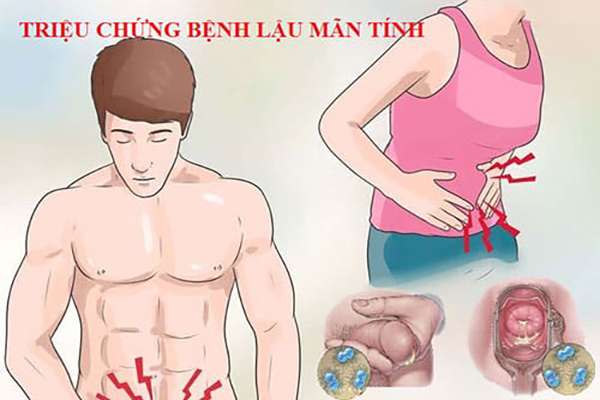 Trieu-chung-benh-lau-man-tinh