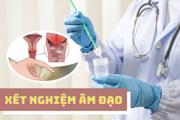 Nguyên nhân ngứa dương vật ở nam giới – Cách điều trị hiệu quả