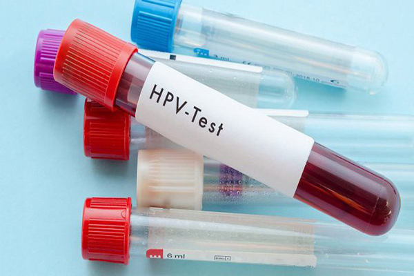 Xét nghiệm HPV là gì? Phương pháp xét nghiệm nhanh chóng và hiệu quả