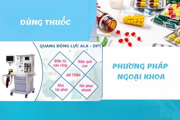 phuong-phap-dieu-tri-sui-mao-ga