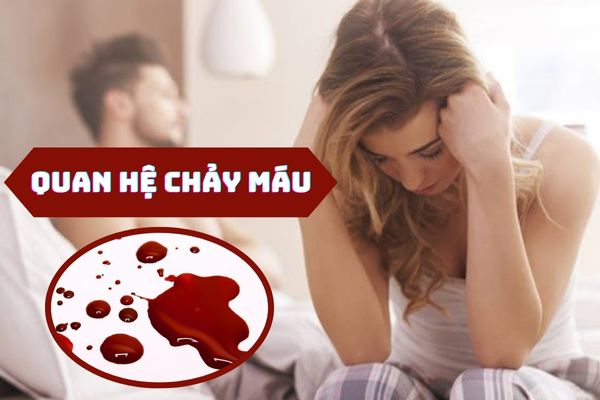 Quan hệ chảy máu do đâu – Phương pháp điều trị hiệu quả