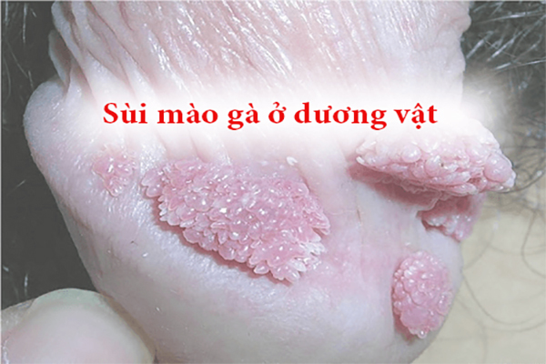 Sui-mao-ga-o-duong-vat