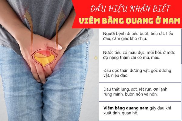 trieu-chung-viem-bang-quang-o-nam-gioi