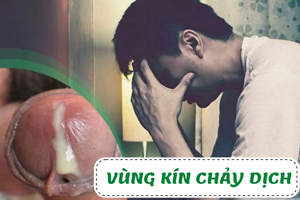 Vùng kín chảy dịch bất thường cảnh báo bệnh gì?