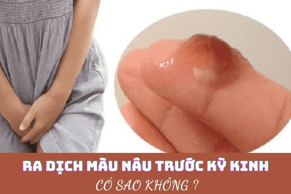 Ra dịch nâu bất thường trước kỳ kinh nguyệt có đáng ngại không?