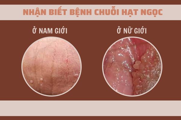 Chuoi-hat-ngoc-o-nam-nu