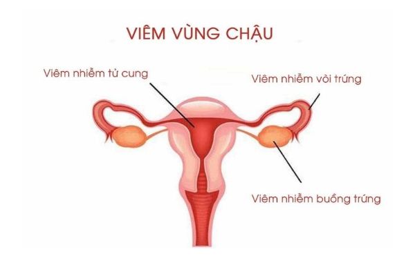 Het-suc-can-trong-voi-tinh-trang-dau-bung-duoi-1